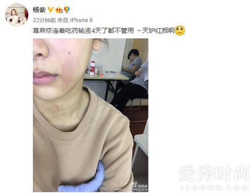 张歆艺抗疫情,张歆艺张芷溪