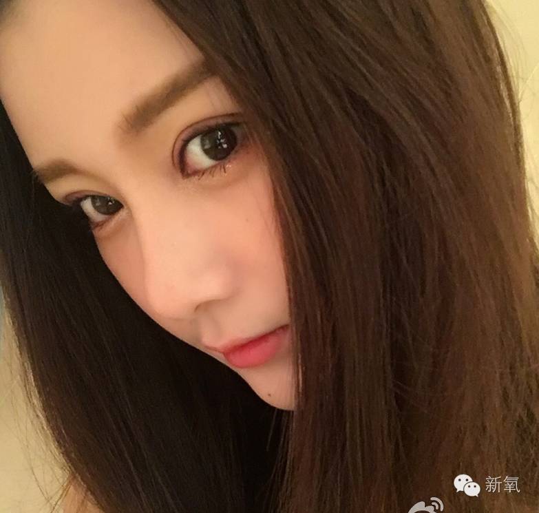 双眼皮变脸真实案例,网红双眼皮最成功的