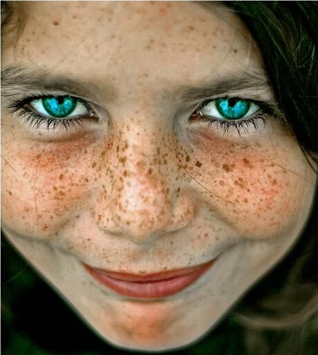 激光祛斑1-15天变化图,皮秒激光祛斑有啥副作用