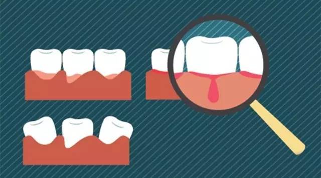 你问我答之鼻子和牙龈出血