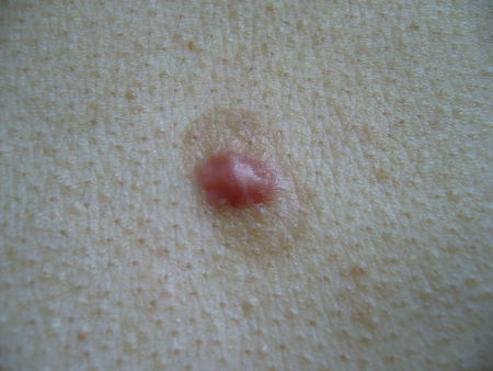 10种家庭常备药清单,家中常备的伤湿止痛膏的20种用法