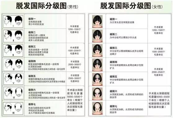 植发手术费用大概多少钱,植发手术费用一览表