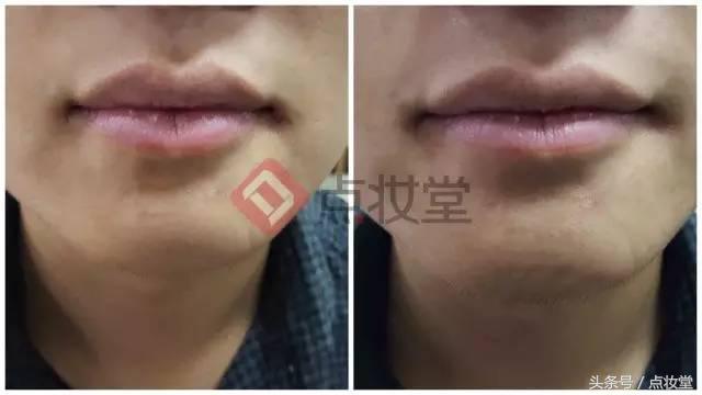 法国贝德玛润唇膏,法国M2A小白管润唇膏