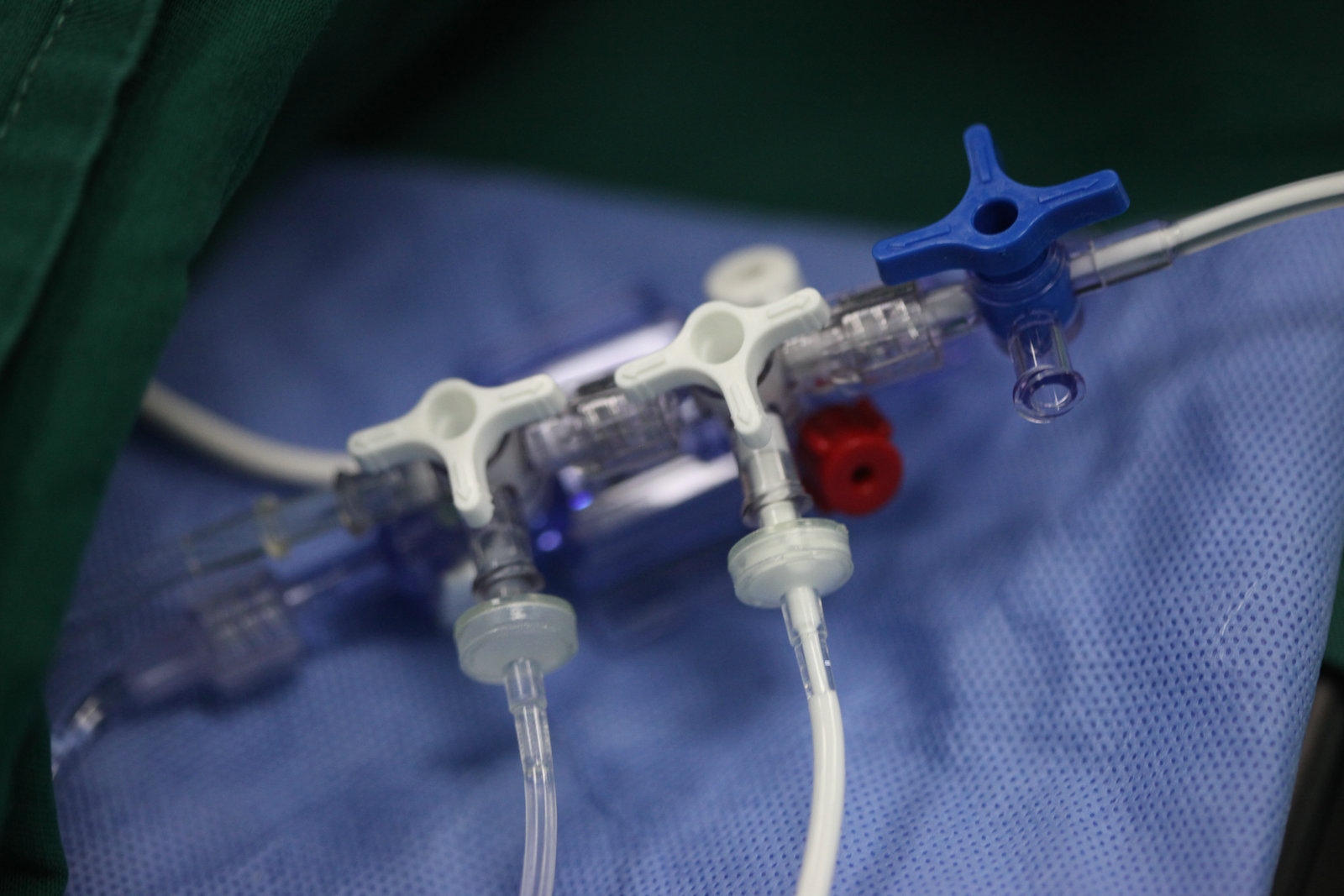 神经外科纪实视频,显微神经外科手术费用