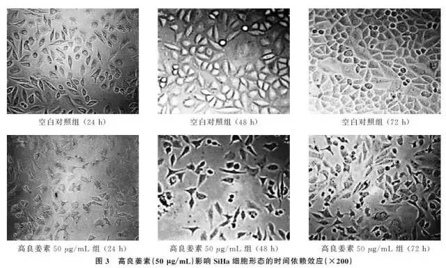 「民族肿瘤学」高良姜素对宫颈癌SiHa细胞凋亡及基因表达的影响