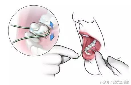 牙线排名第一名不伤牙,16款牙线评测