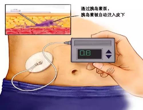 辟谷导致死亡,辟谷致死案例