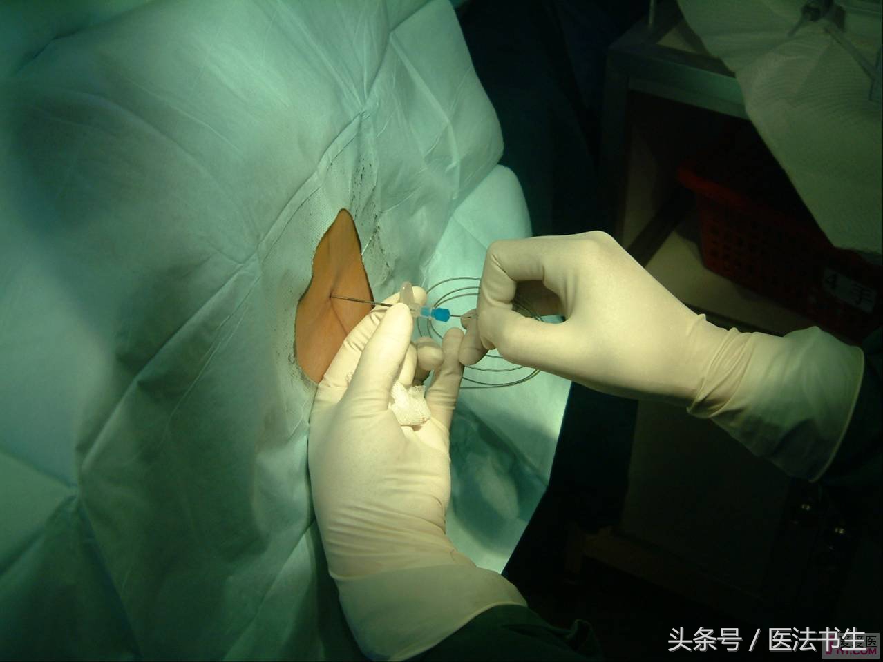 二胎顺产没有头胎疼吗,二胎顺产不压肚子吗