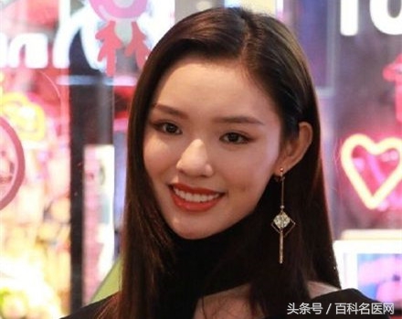 整牙可以变好看吗,整牙可以变成瓜子脸吗