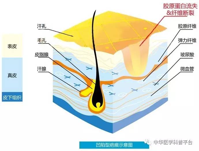 每天都在洗，皮肤这道“城墙”是怎样建成的