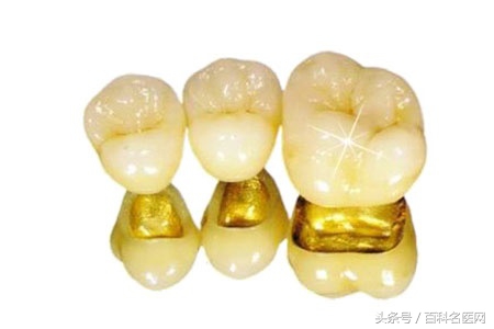 整牙可以变好看吗,整牙可以变成瓜子脸吗