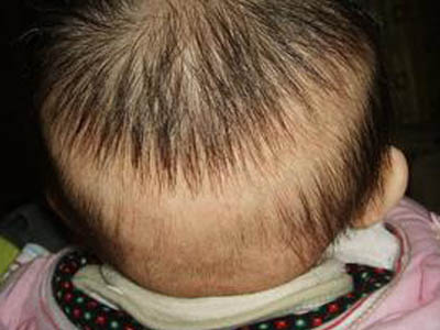 宝宝背后有什么秘密,宝宝身上藏的小秘密