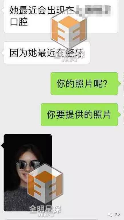 林允整牙却像整容？她是真的又整了啊！