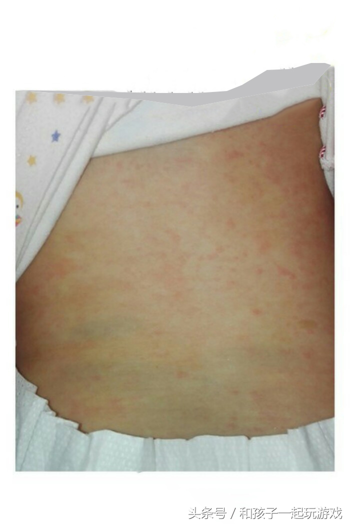 真想抽自己个大嘴巴！因为我的摇摆不定，宝宝白挨一针