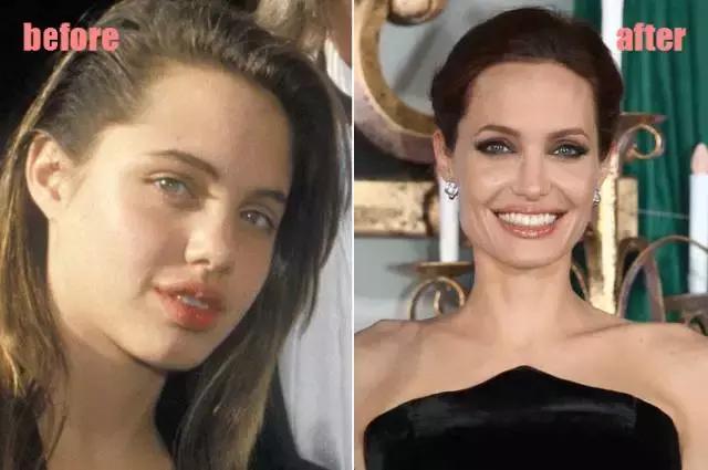 整牙=整容？看杨幂、刘涛、高圆圆为你亲身示范！