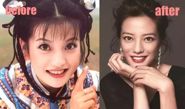 整牙=整容？看杨幂、刘涛、高圆圆为你亲身示范！