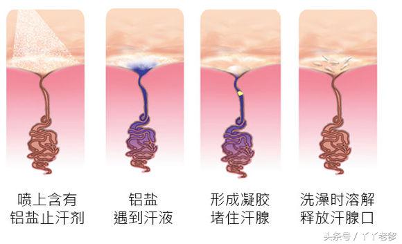 科学揭秘狐臭的故事,怎样判断是真的狐臭还是假的狐臭