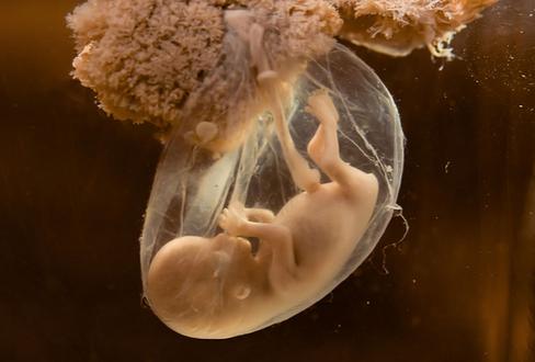 孕期羊水知识大全,揭秘羊水穿刺的神秘面纱