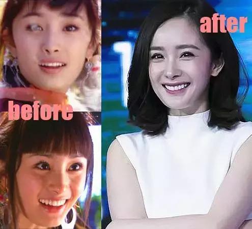 整牙=整容？看杨幂、刘涛、高圆圆为你亲身示范！