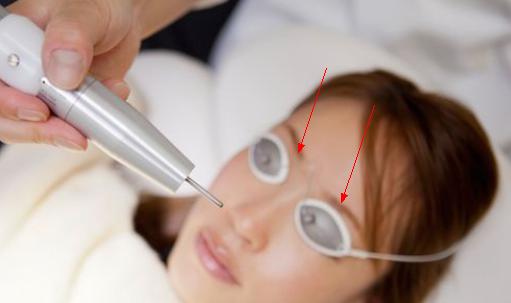 双眼皮“留疤”要多难看多难看，如何防止，留疤如何挽回？