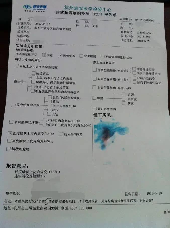 宫颈癌筛查tct正常报告单,宫颈癌筛查报告单怎么看tct