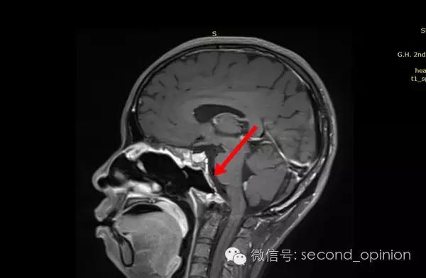 中国的质子中心有几家,全国有几所质子医院哪所最好