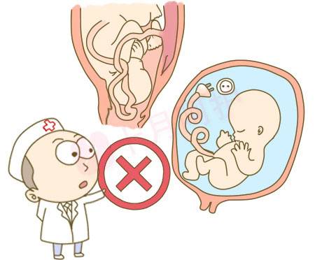 “脐带脱垂”来了！麻醉科的你准备好了吗？