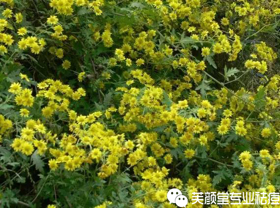 野菊花祛痘痘用法,野菊祛痘