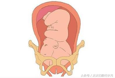 28周入盆后注意事项,孕妇三十七周已经入盆