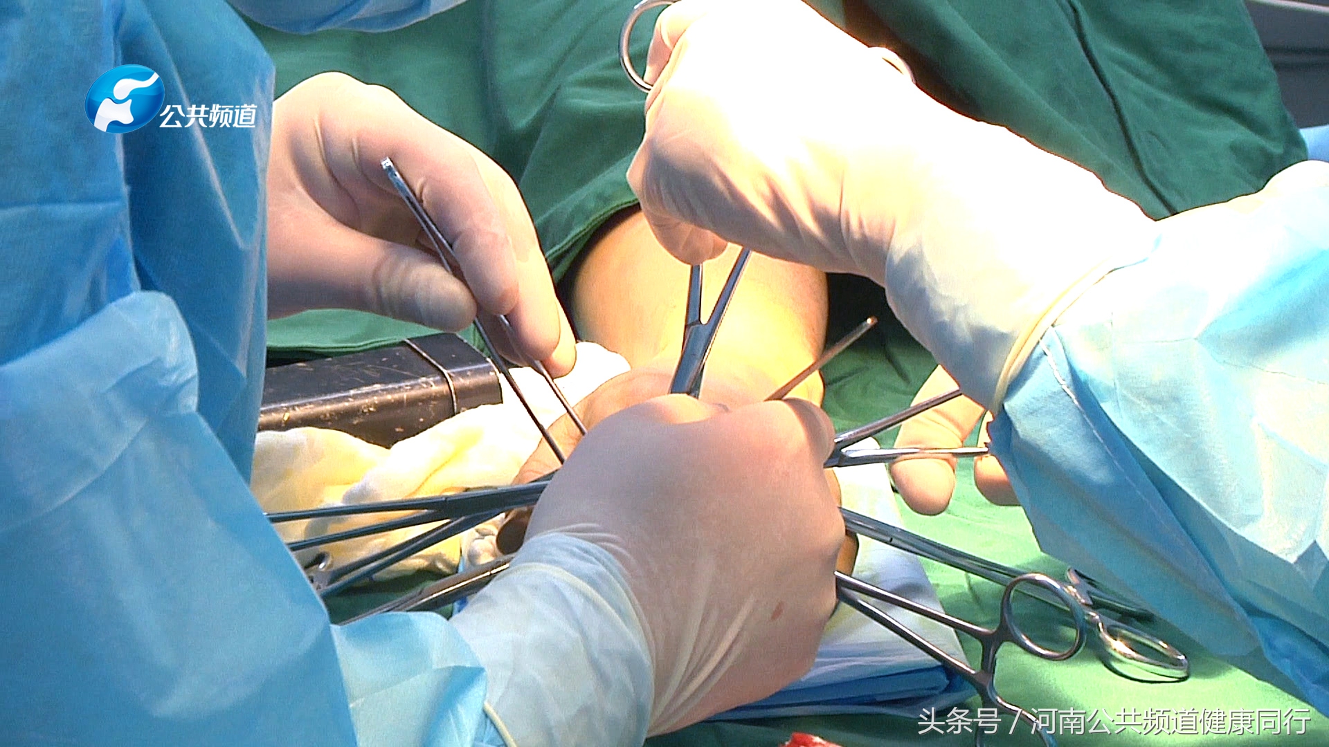 亳州市人民医院手足显微外科,河南省人民医院手足显微外科