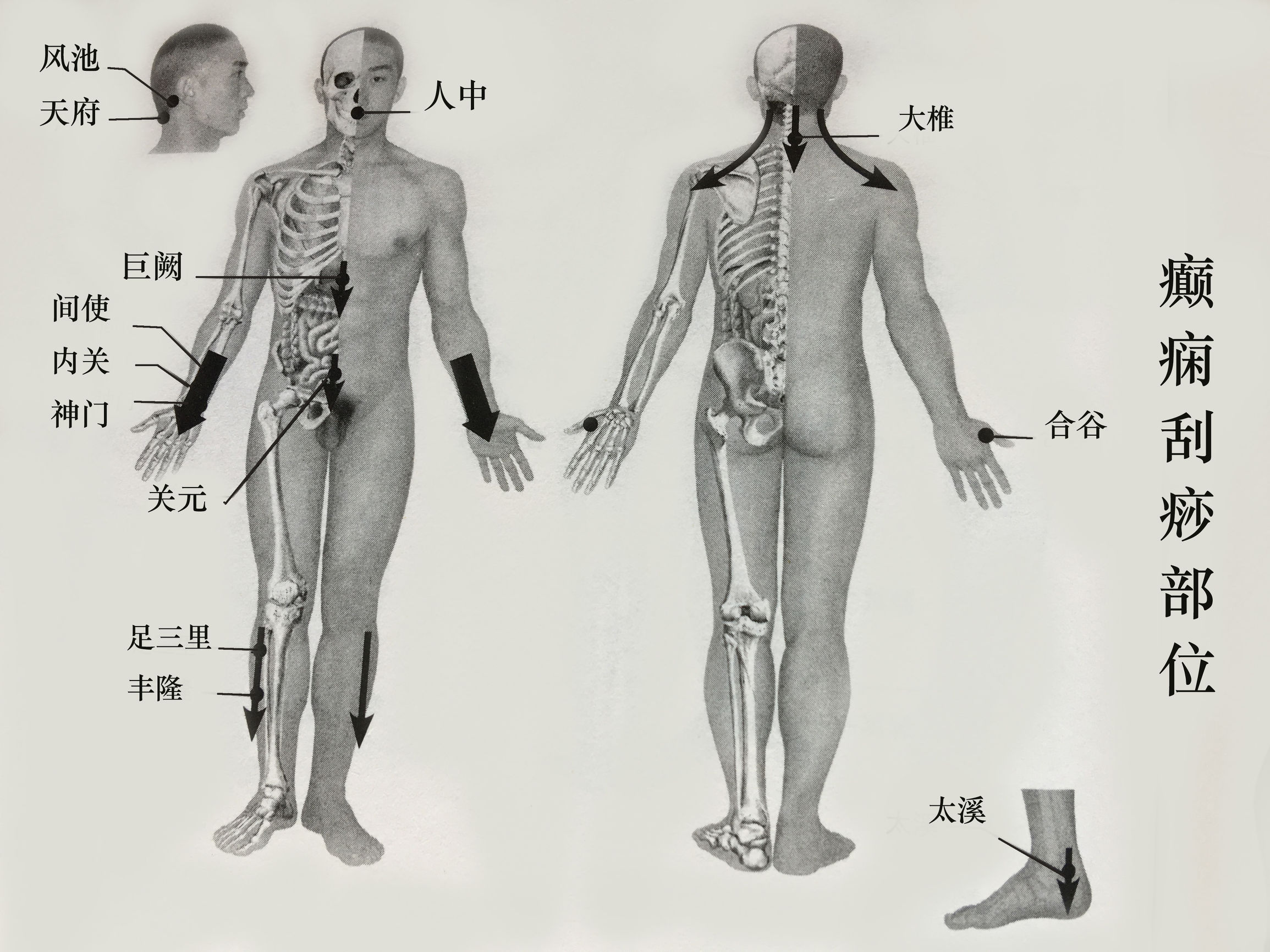 硬皮病针灸疗法能治愈吗,硬皮病针灸处方