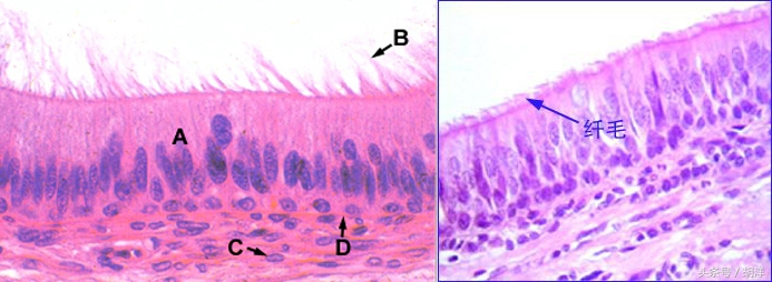 咳嗽气管炎3天自愈最佳疗法,气管炎咳嗽一个星期还是不好