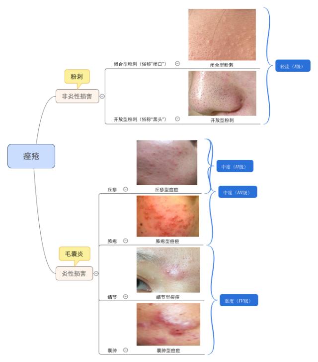 刘歪歪脱骨凤爪凉拌菜,刘歪歪的作品原声
