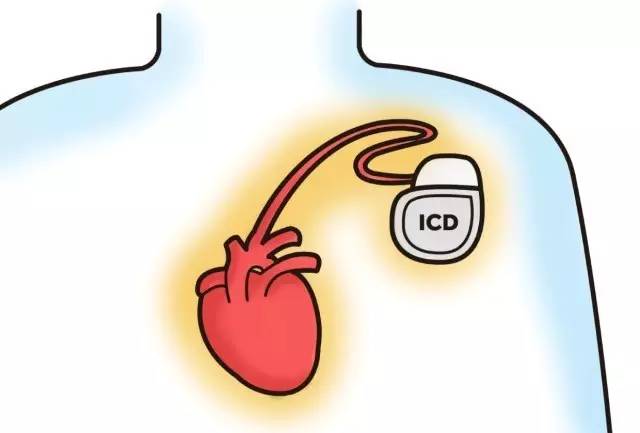 心室泵力不足会导致血压低吗,心室泵力不足的危害