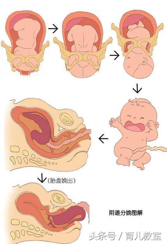 自然分娩的三个产程，打算顺产的准妈妈千万要记得