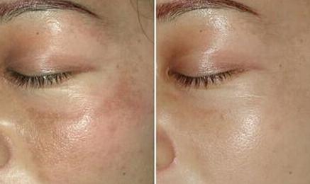 黄豆加黑豆有什么副作用,黄豆和黑豆一起吃能降血压吗