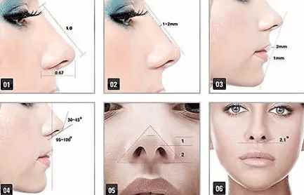 韩式隆鼻因为“韩式”价格翻番，汇总你都踩过多少坑？
