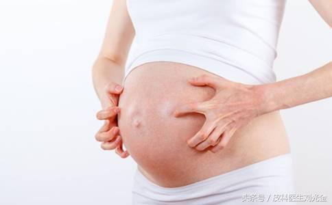 孕妇得了*麻疹荨**能不能用药？