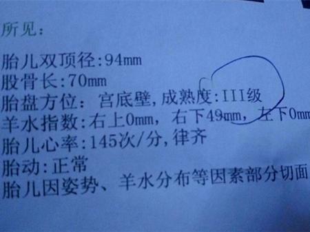 30周羊水指数正常范围四个数值,怀孕七个半月b超单羊水正常数值