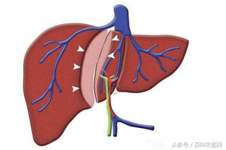 肝火旺的五大症状及调节方法,肝火旺的十大症状怎么调理