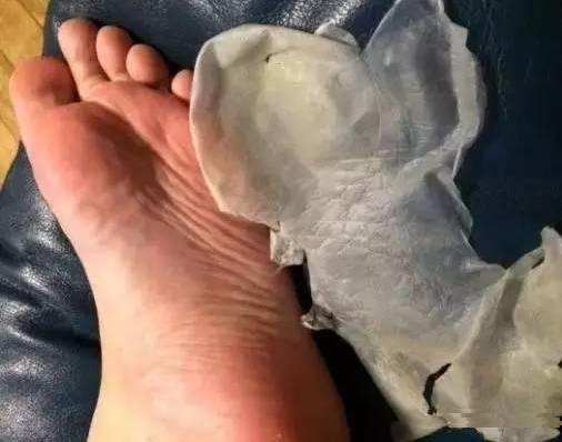 日本一大妈抠脚皮赚1亿,日本大爷靠撕脚皮狂赚20亿