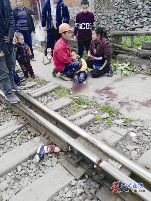 男孩被车碾压后截肢,小孩放学惨遭车撞双腿截肢