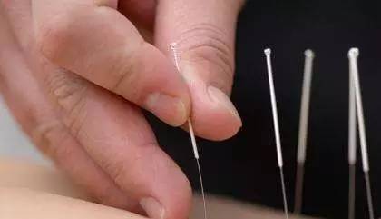 西苑医院偏头痛,脑病科头疼原因