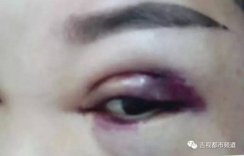 伶秀天成美容院,伶秀天成医疗美容好吗