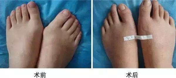 高跟鞋还是少穿吧，许多明星的高颜值，都毁在了一双脚上！