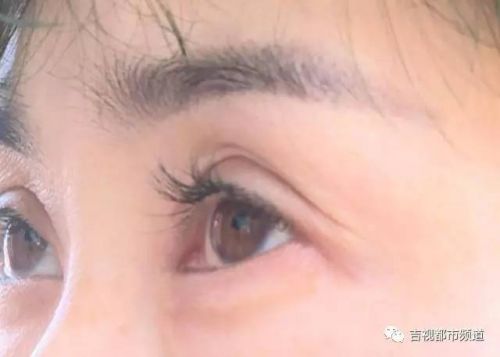 伶秀天成美容院,伶秀天成医疗美容好吗