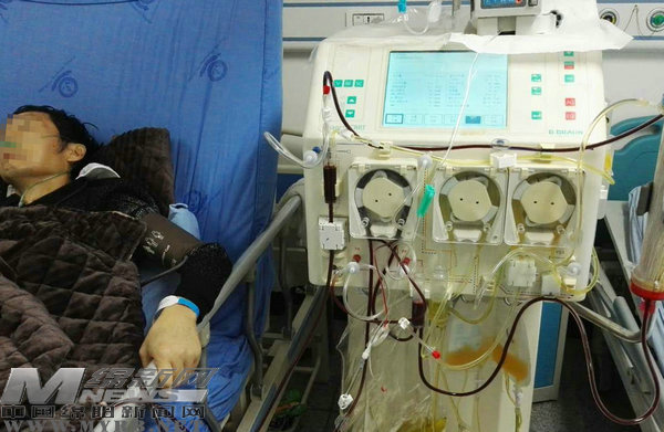 血浆置换联合crrt治疗的个案护理,crrt血浆置换视频