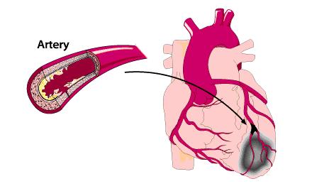 收藏！十个保健小动作，每天坚持，堪比灵丹妙药！