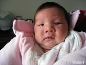 宝宝反复湿疹对付湿疹有妙招,反复湿疹怎么治才能除根