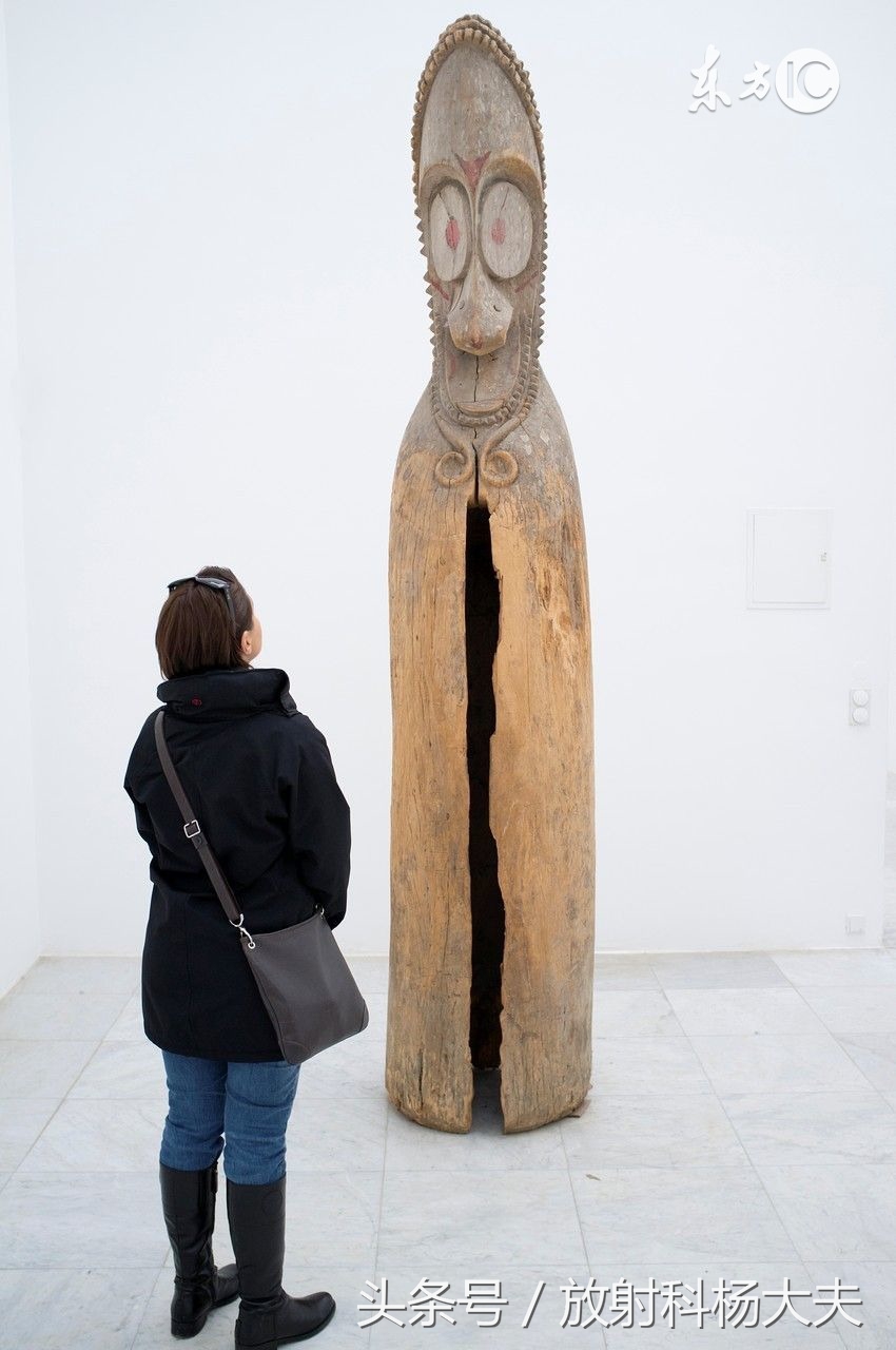 垂体腺瘤乳房还分泌乳汁是咋回事,乳房垂体有问题是什么症状